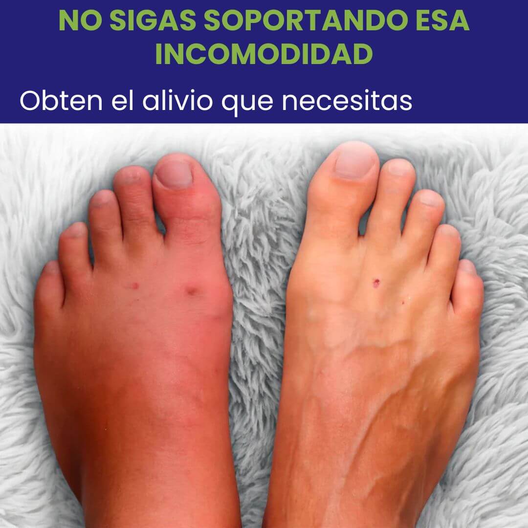 Crema Neuropatía Alivio Suave para Hormigueo y Ardor