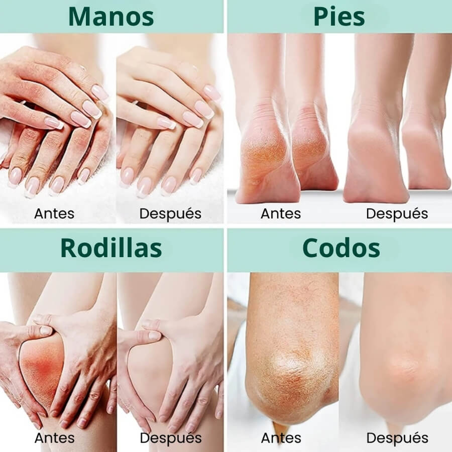 Crema de Urea Máxima Hidratación